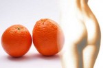 Cosa è la cellulite